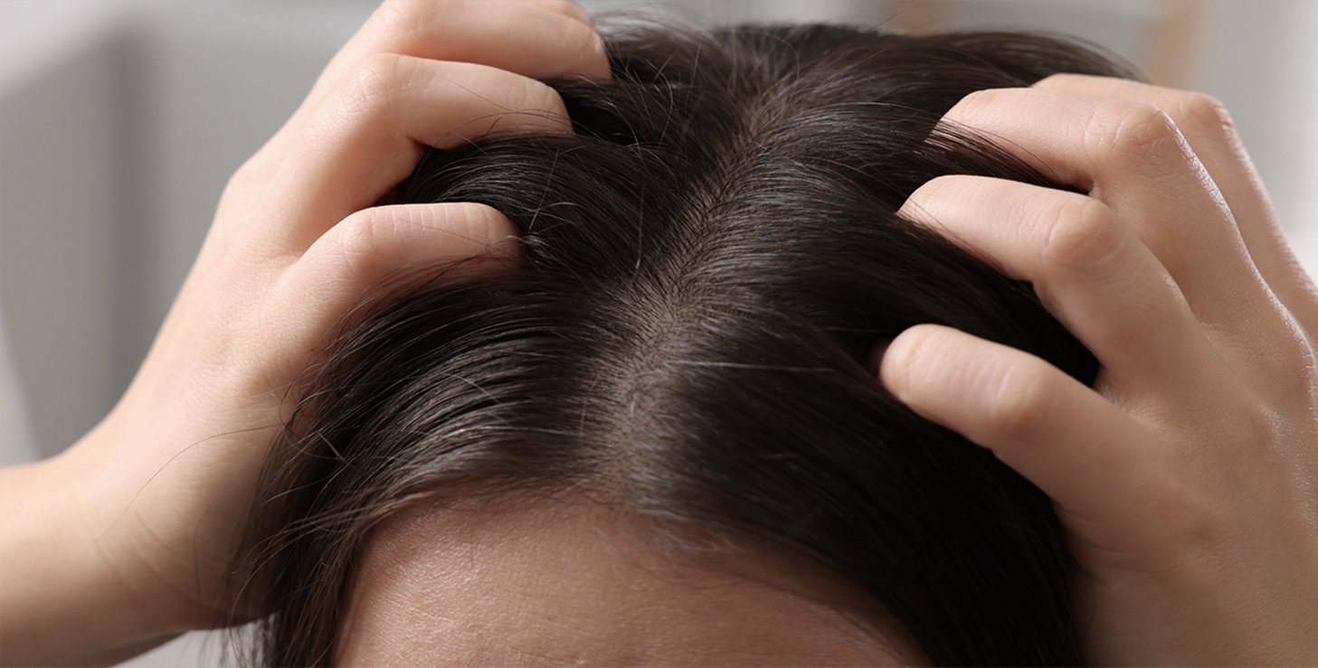 Problematična kosa i vlasište